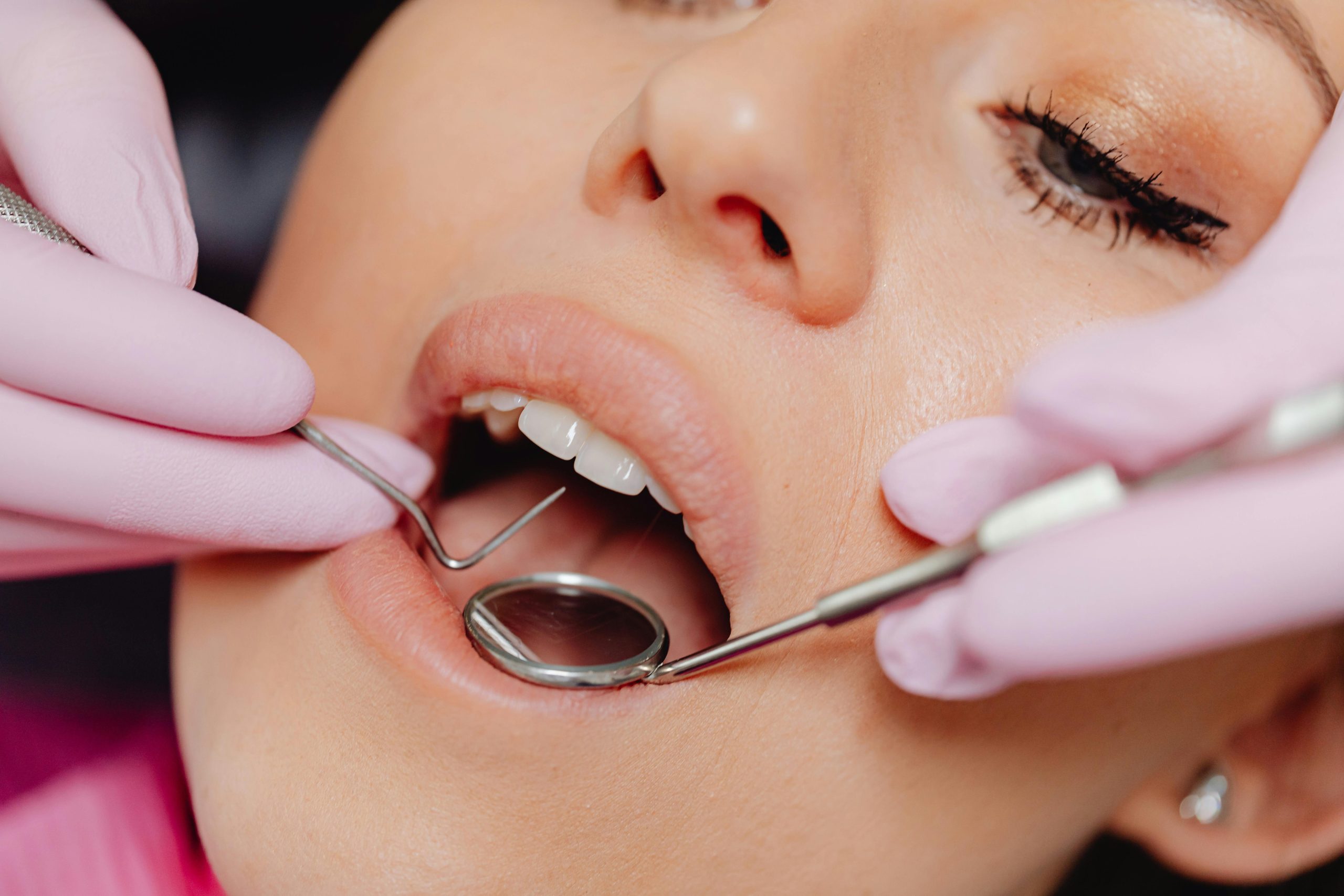Dental Implants