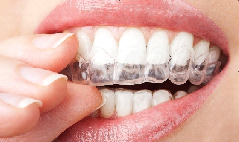 Orthodontics