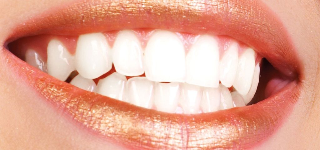 Teen orthodontics Hawthorn
